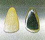 硬質レジン前装冠 前装冠
