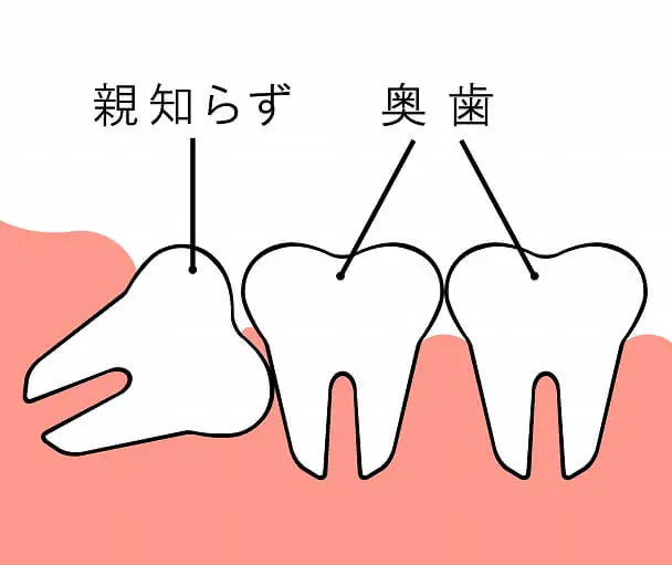 親知らず