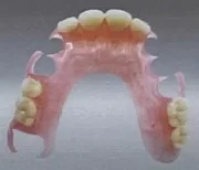 ノンクラスプデンチャー